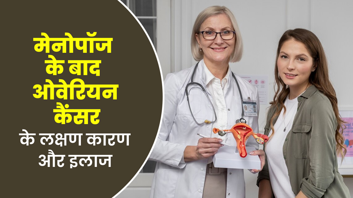 मेनोपॉज के बाद भी हो सकता है ओवेरियन कैंसर, जानें इसके लक्षण कारण और इलाज