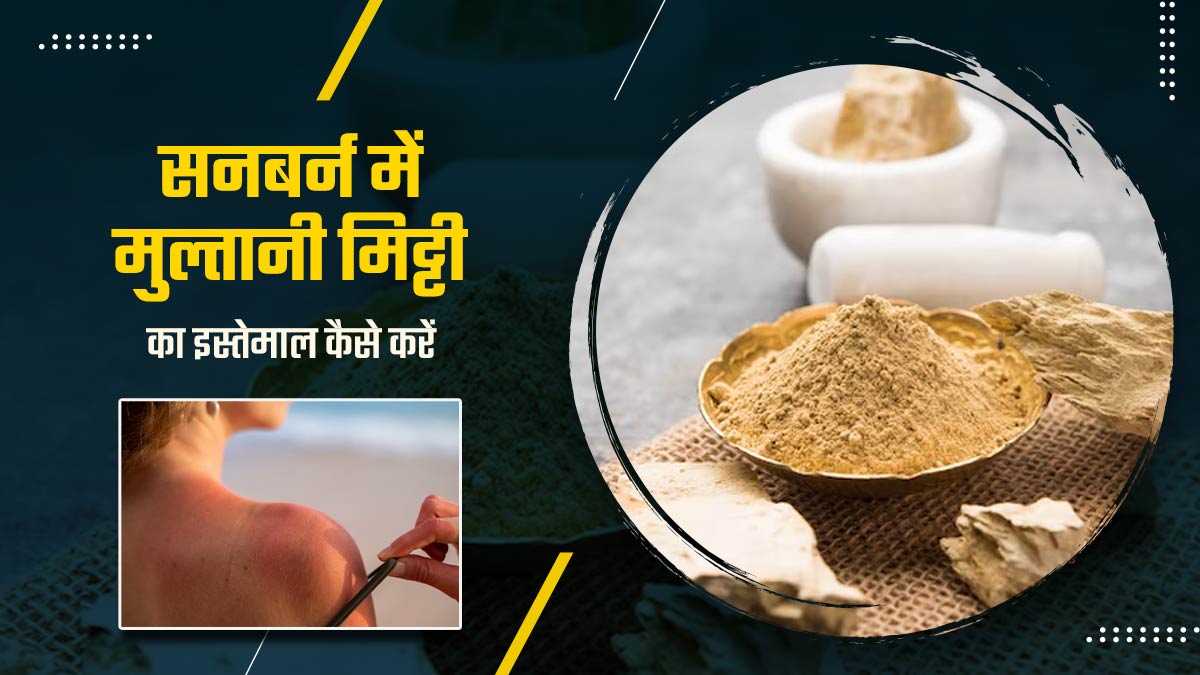सनबर्न हटाने में कारगर है मुल्तानी मिट्टी, ऐसे करें इस्तेमाल