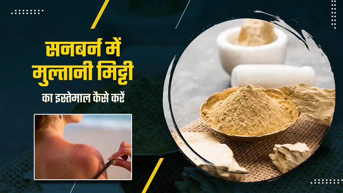 सनबर्न हटाने में कारगर है मुल्तानी मिट्टी, ऐसे करें इस्तेमाल
