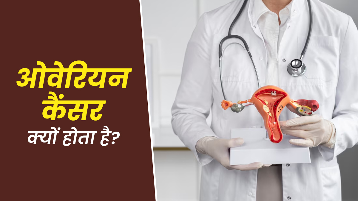 ओवेरियन कैंसर क्यों होता है? डॉक्टर से जानें