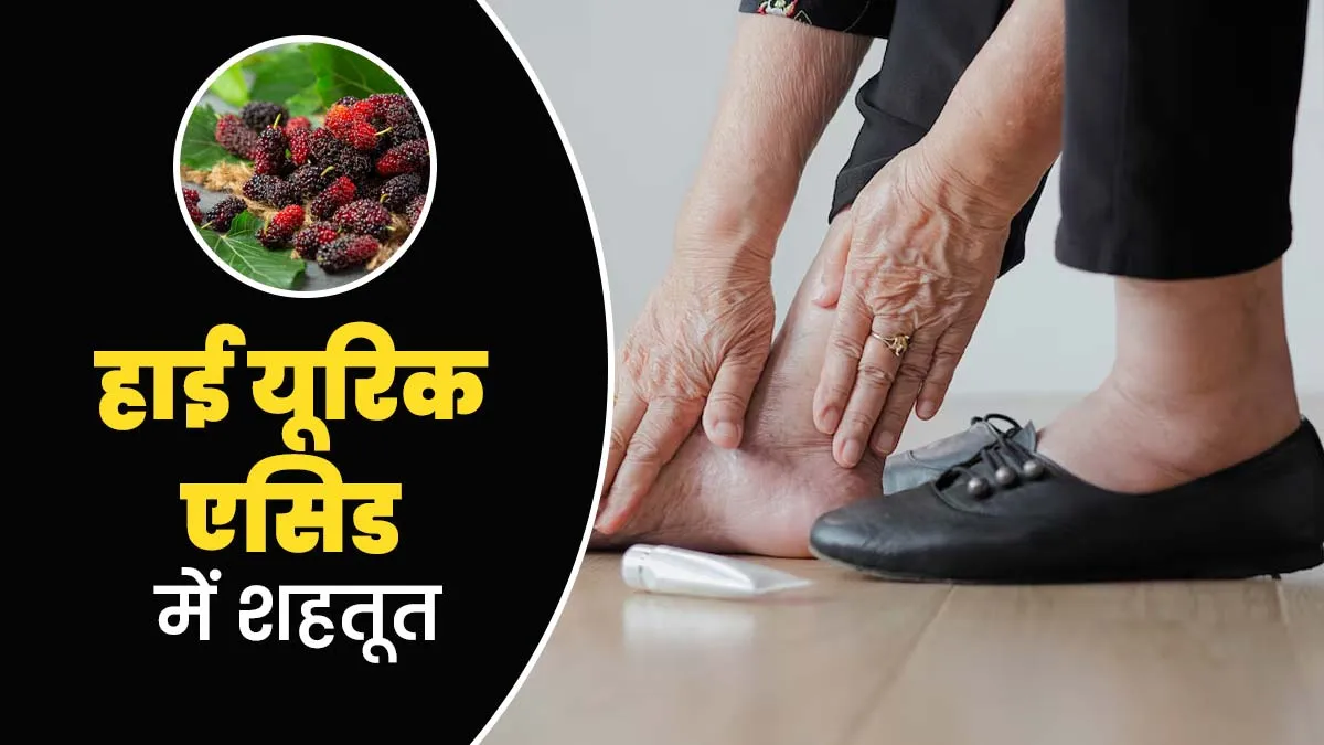 हाई यूरिक एसिड में शहतूत खाना कैसे फायदेमंद है? एक्सपर्ट से जानें तरीका