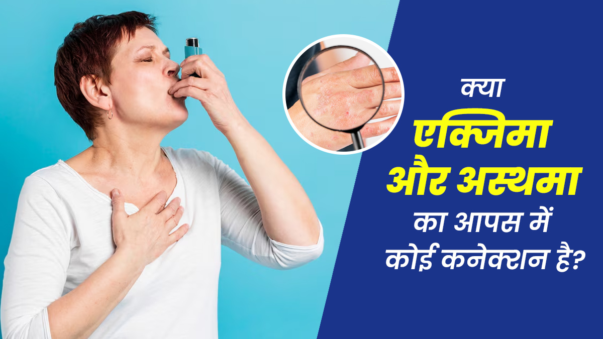 क्या एक्जिमा और अस्थमा का आपस में कोई कनेक्शन है? जानें डॉक्टर से
