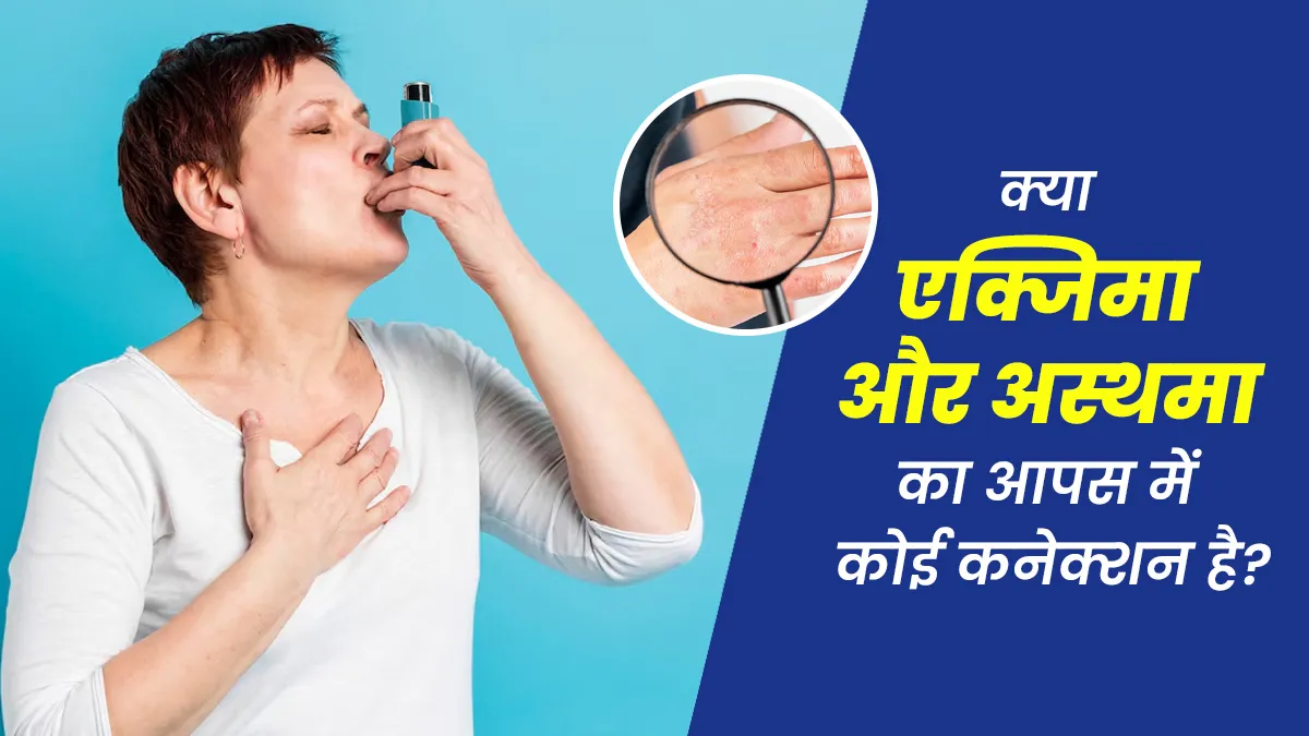 क्या एक्जिमा और अस्थमा का आपस में कोई कनेक्शन है? जानें डॉक्टर से