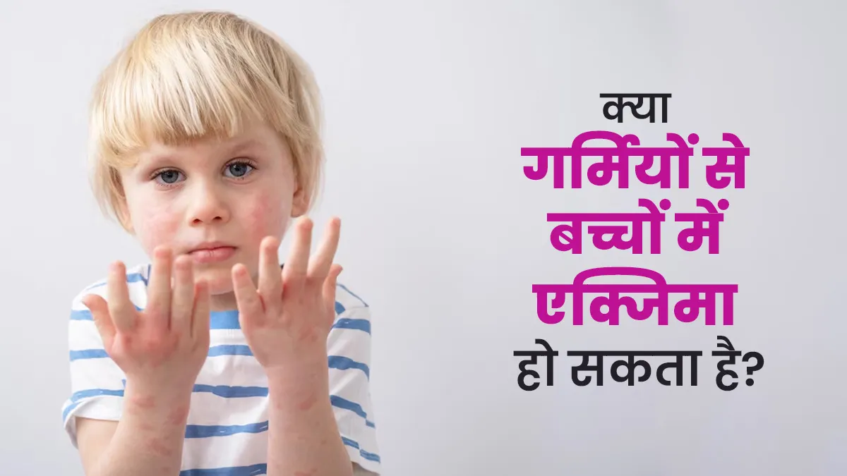 क्या गर्मियों के कारण बच्चों में एक्जिमा हो सकता है? जानें डॉक्टर से
