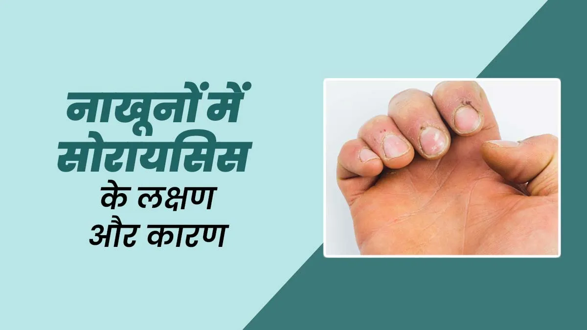 आपके नाखूनों पर भी हो सकती है सिरोसिस की समस्या, जानें इसके लक्षण और कारण