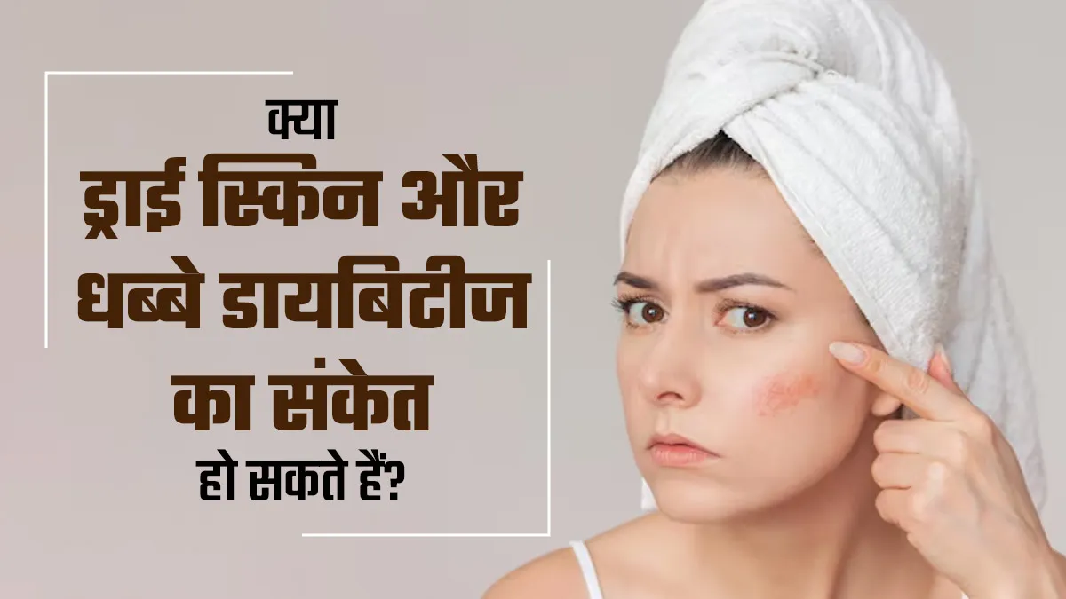 क्या ड्राई स्किन और धब्बे डायबिटीज का संकेत हो सकते हैं? डॉक्टर से जानें