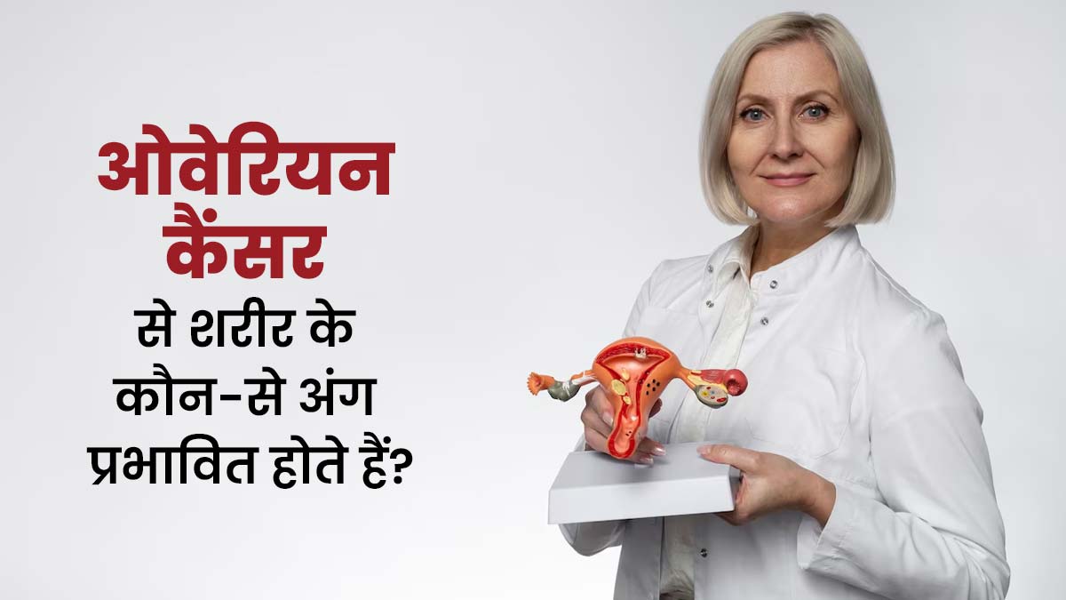 ओवेरियन कैंसर आपके शरीर को कैसे प्रभावित कर सकता है? डॉक्टर से जानें