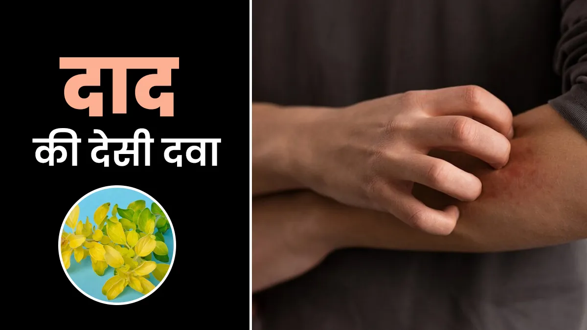 दाद की समस्या में कैसे फायदेमंद है सेना के पत्ते? एक्सपर्ट से जानें उपयोग का तरीका