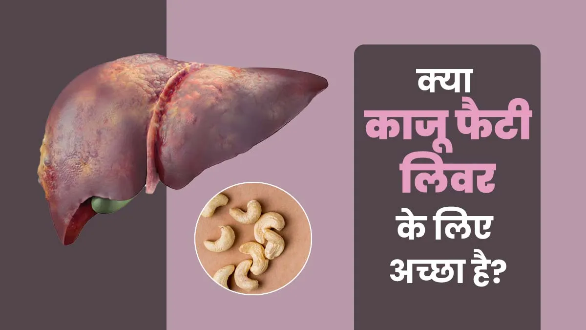 क्या काजू फैटी लिवर के लिए अच्छा है? एक्सपर्ट से जानें