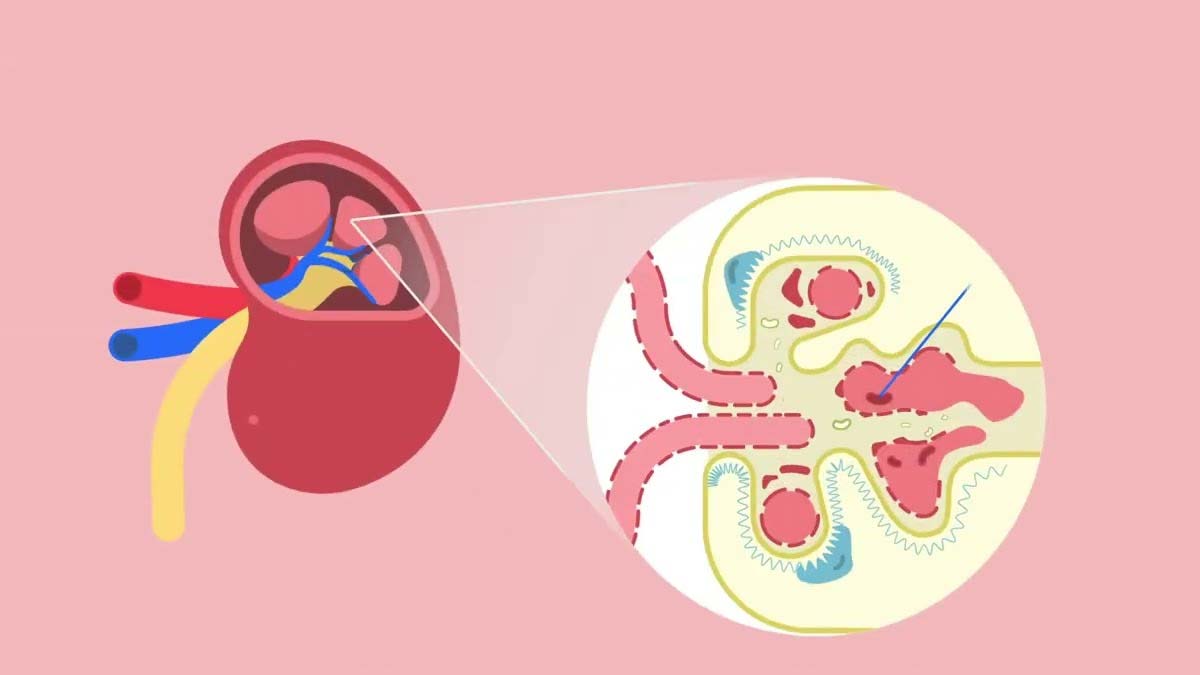 high-potassium-in-kidney