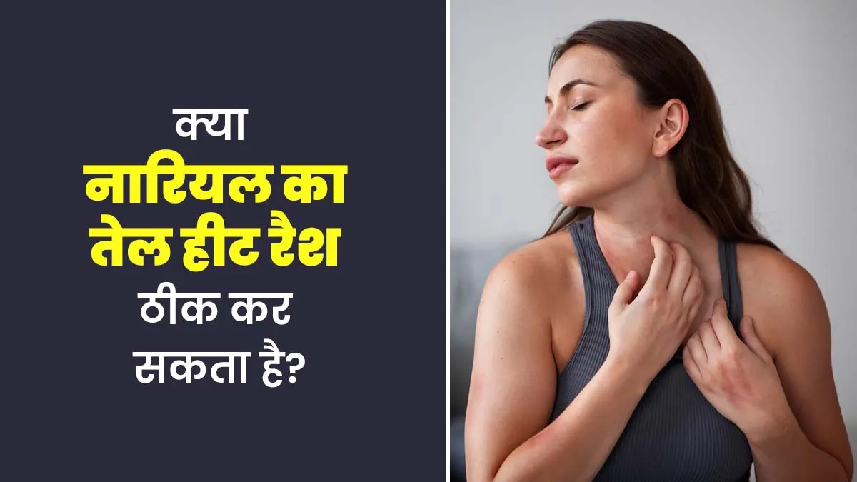 क्या नारियल का तेल हीट रैश को ठीक कर सकता है? जानें डॉक्टर से