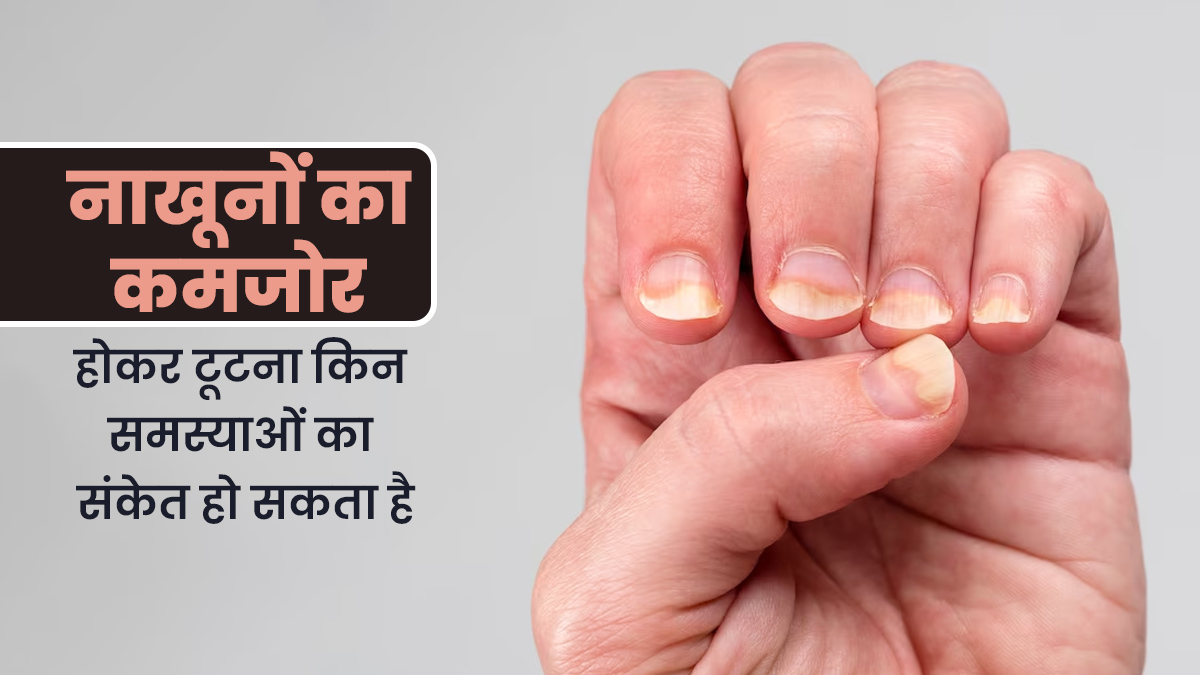 टूटे और कमजोर नाखून हो सकते हैं इन 5 बीमारियों का संकेत, न करें लापरवाही
