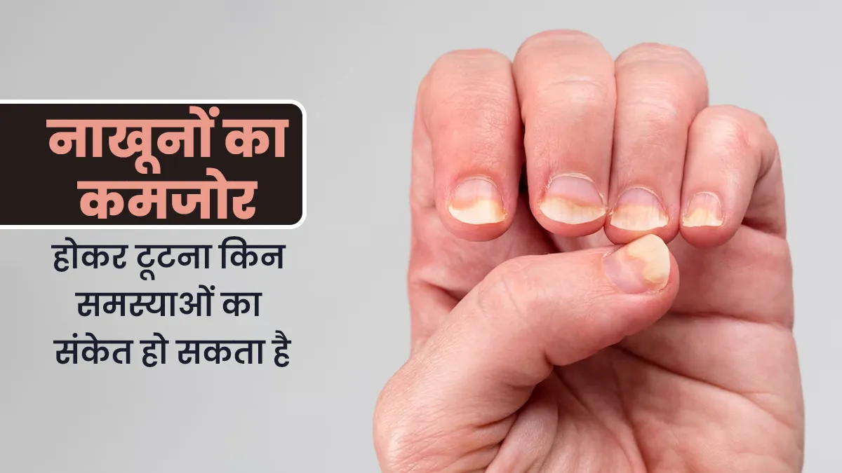 टूटे और कमजोर नाखून हो सकते हैं इन 5 बीमारियों का संकेत, न करें लापरवाही