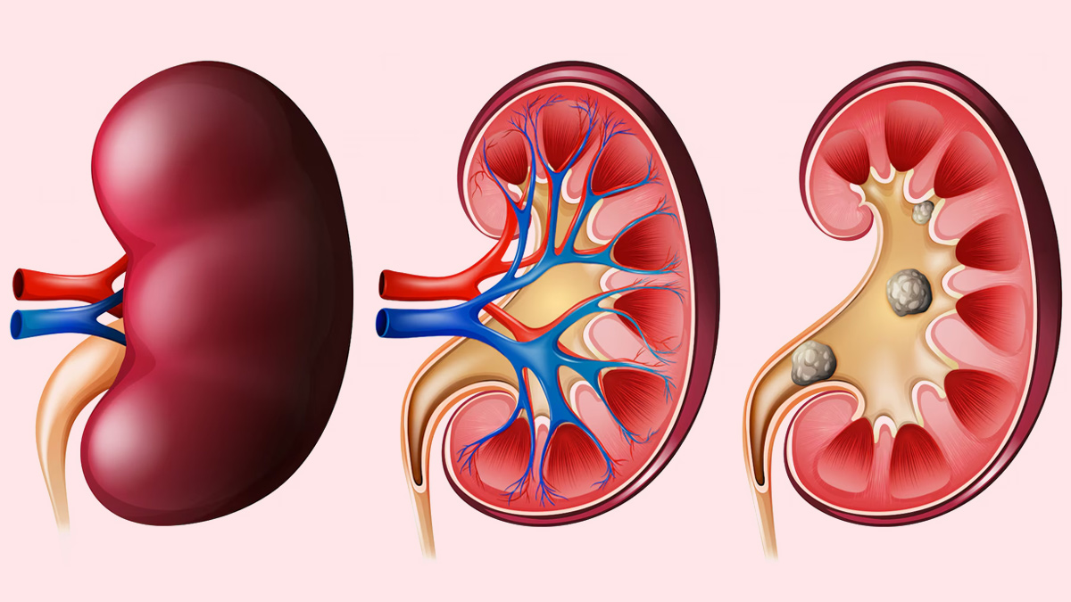 can drinking too much water harm kidneys 1 (2)