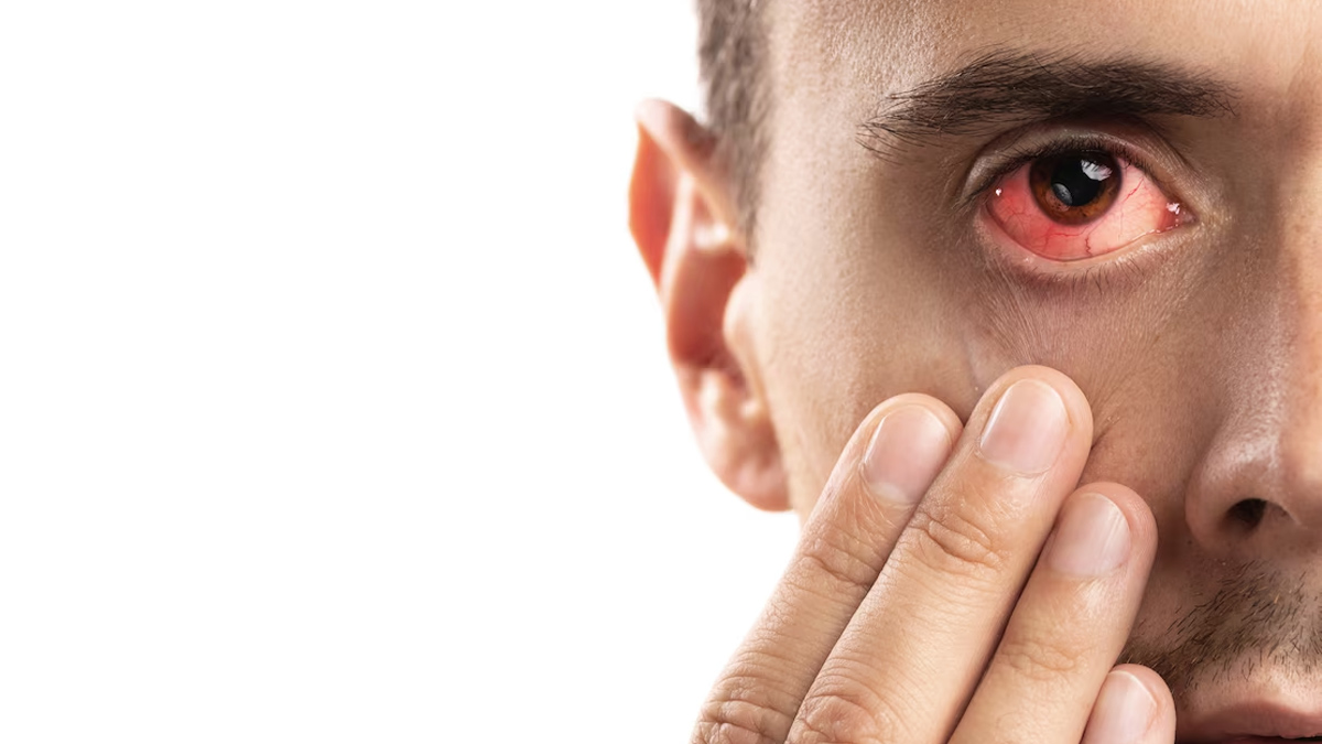 tips to prevent eye stroke during heatstroke 01 (5)