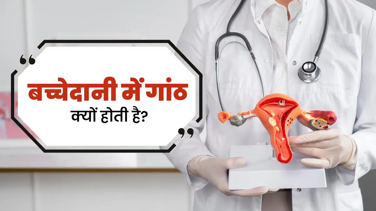 बच्चेदानी में गांठ क्यों होती है? जानें डॉक्टर से जानें