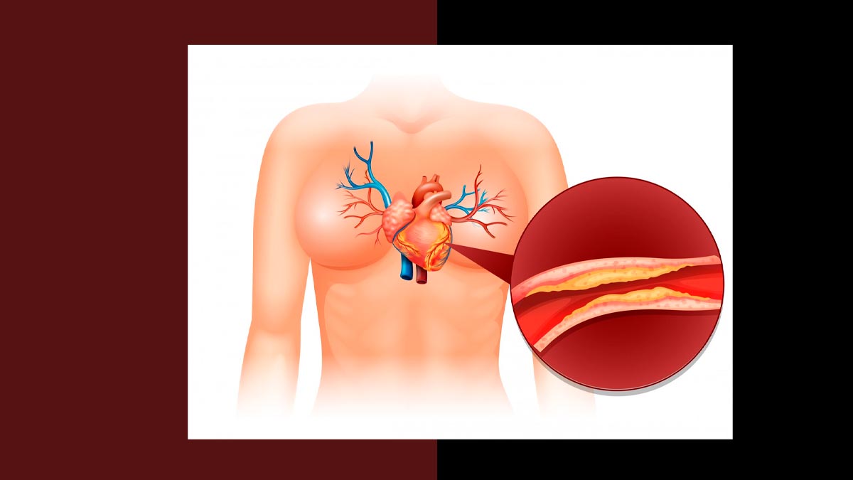 does-eating-raisins-increase-cholesterol in