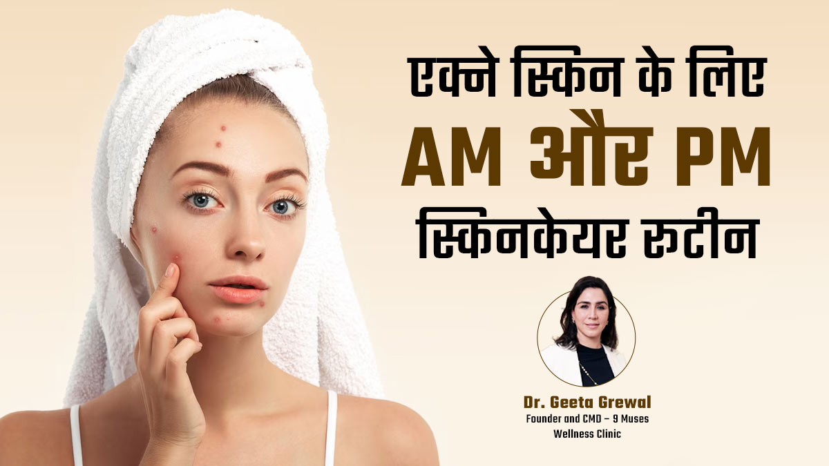 गर्मियों में मुंहासे वाली स्किन को रखना है हेल्दी तो फॉलो करें सुबह और रात का ये स्किनकेयर रूटीन