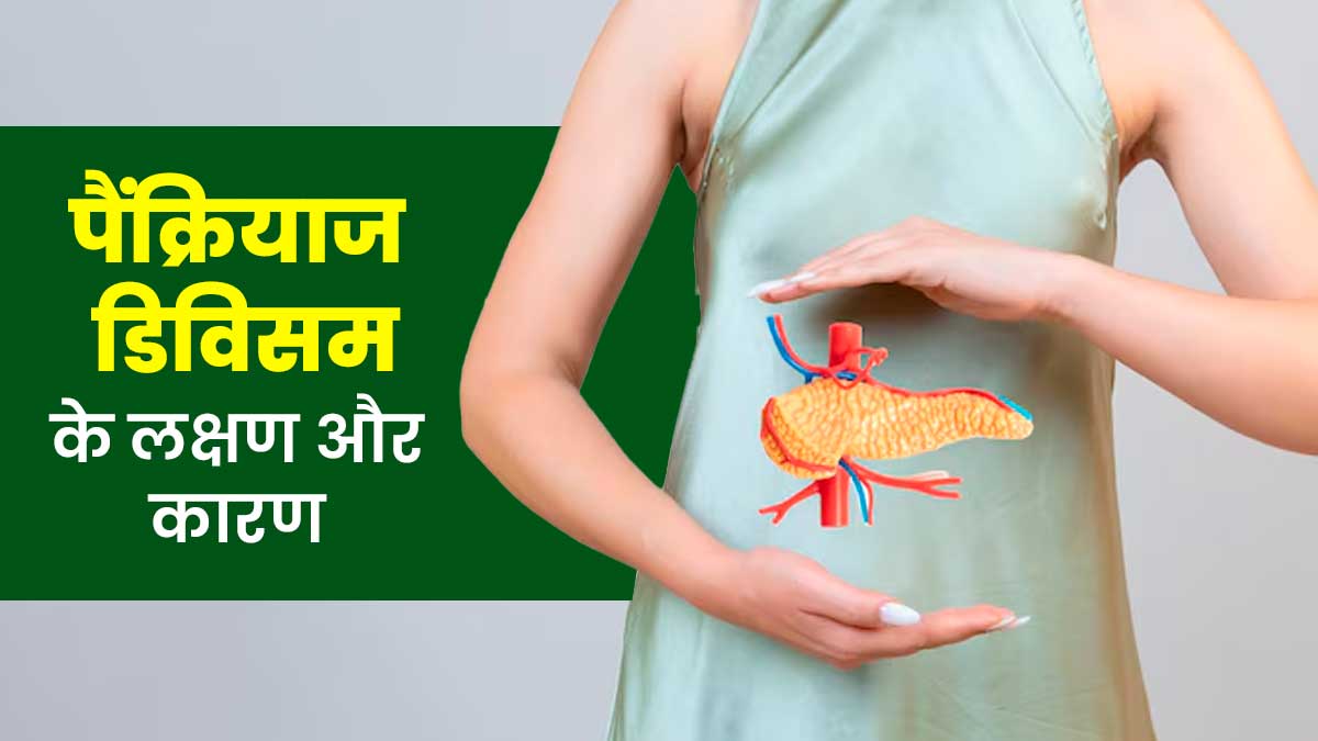 पेट दर्द से लेकर उल्टी तक हो सकते हैं पैंक्रियाज डिविसम के लक्षण, डॉक्टर से जानें इसके कारण