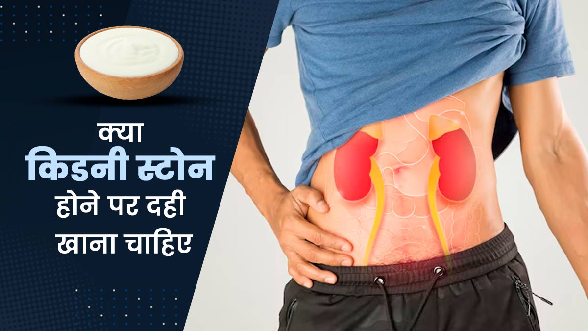क्या किडनी स्टोन होने पर दही खाना चाहिए? जानें क्या कहते हैं एक्सपर्ट