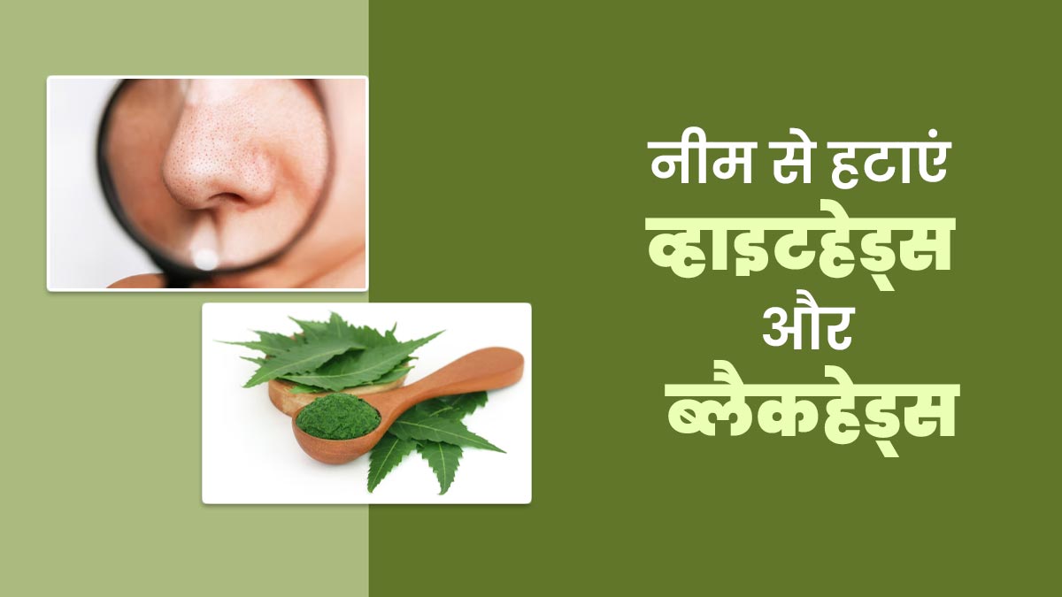 नीम की पत्तियों से पाएं साफ स्किन, व्हाइटहेड्स और ब्लैकहेड्स से भी मिलेगा छुटकारा