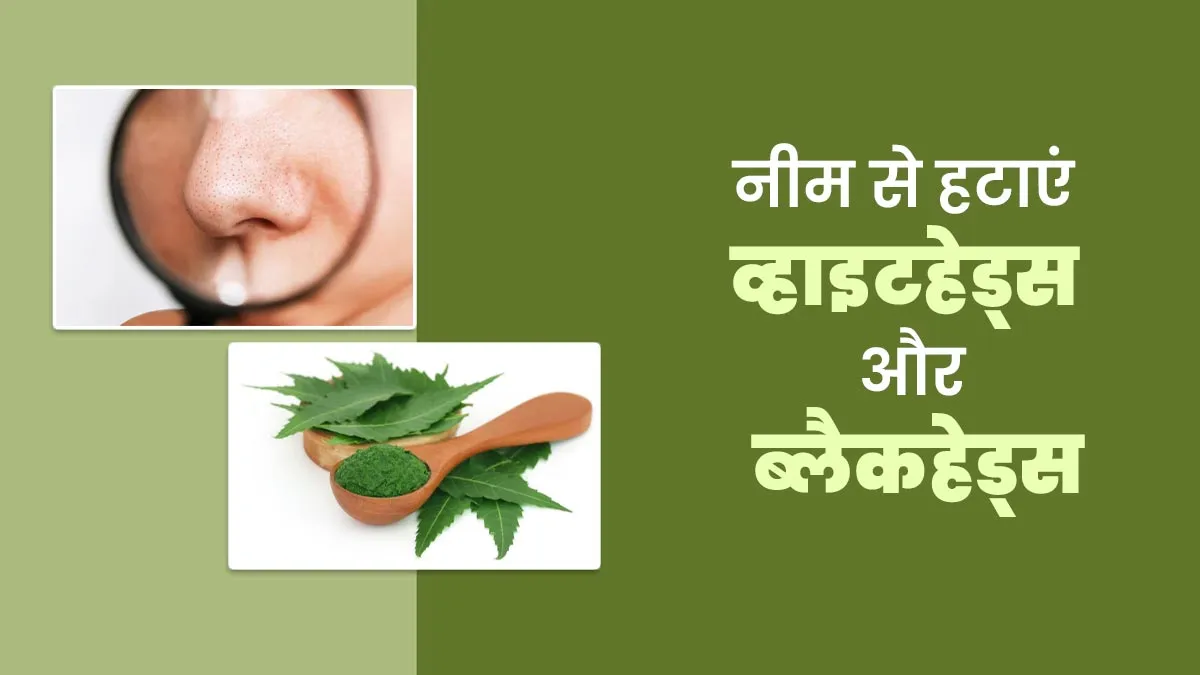 नीम की पत्तियों से पाएं साफ स्किन, व्हाइटहेड्स और ब्लैकहेड्स से भी मिलेगा छुटकारा