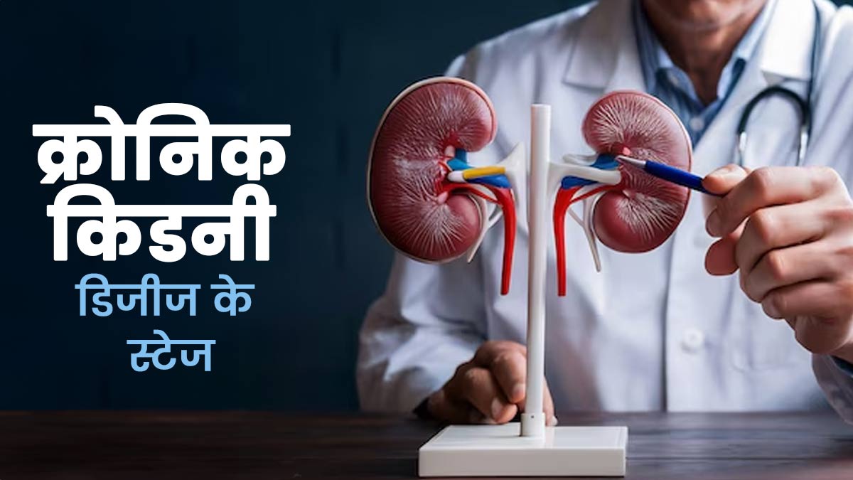 क्रोनिक किडनी डिजीज के क्या स्टेजेस हैं? डॉक्टर से जानें