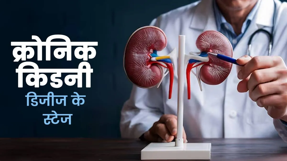 क्रोनिक किडनी डिजीज के क्या स्टेजेस हैं? डॉक्टर से जानें