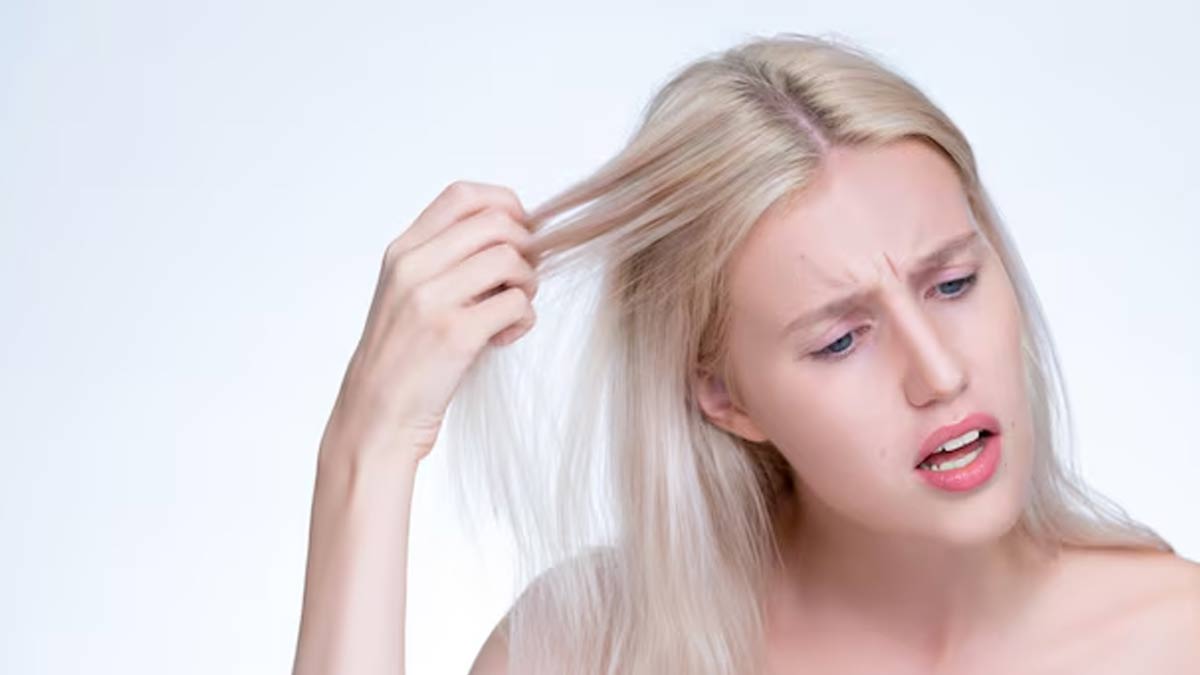 Safed balon ki samasya dur karne ke upay