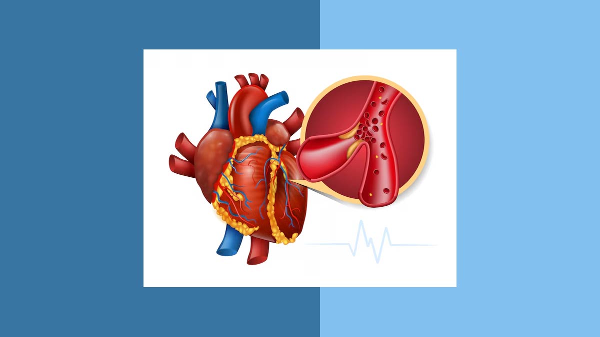 does obesity have an impact on cardiovascular system in hindi 01 (3)