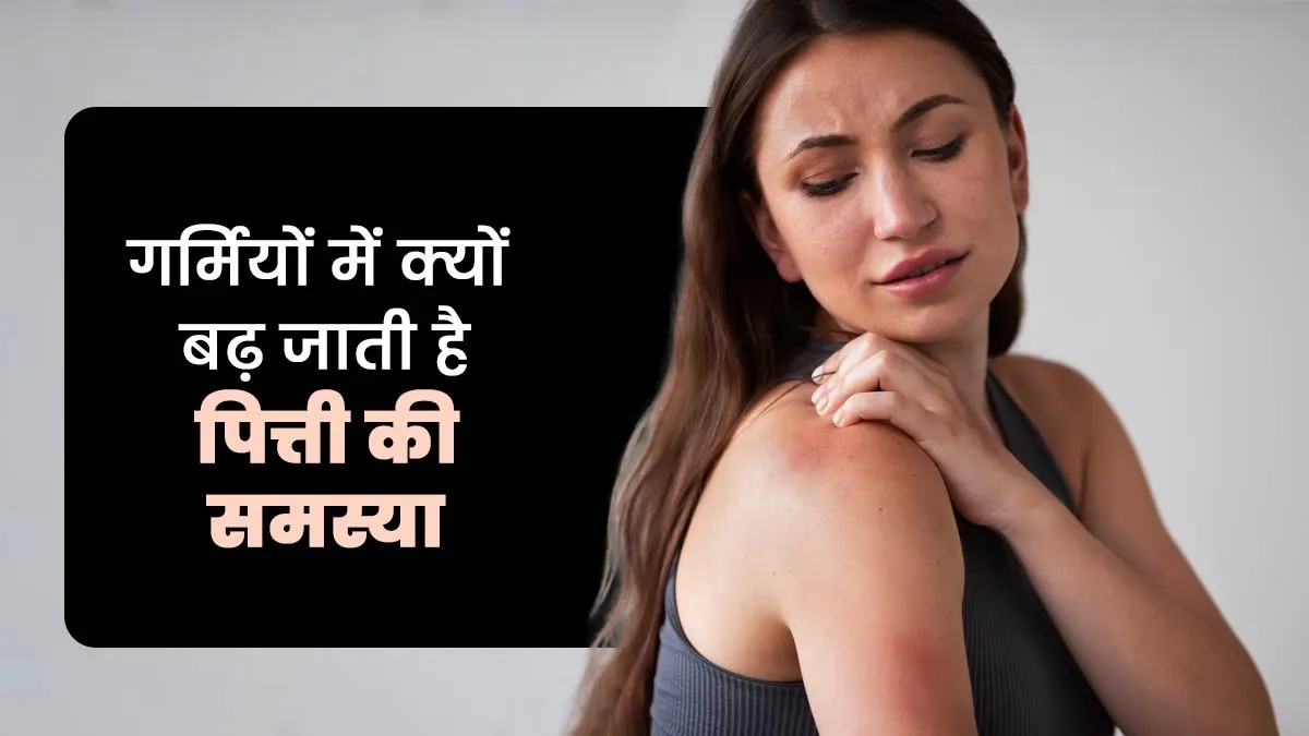 गर्मियों में क्यों बढ़ जाती है पित्ती (urticaria) की समस्या, जानें इसके जोखिम कारक