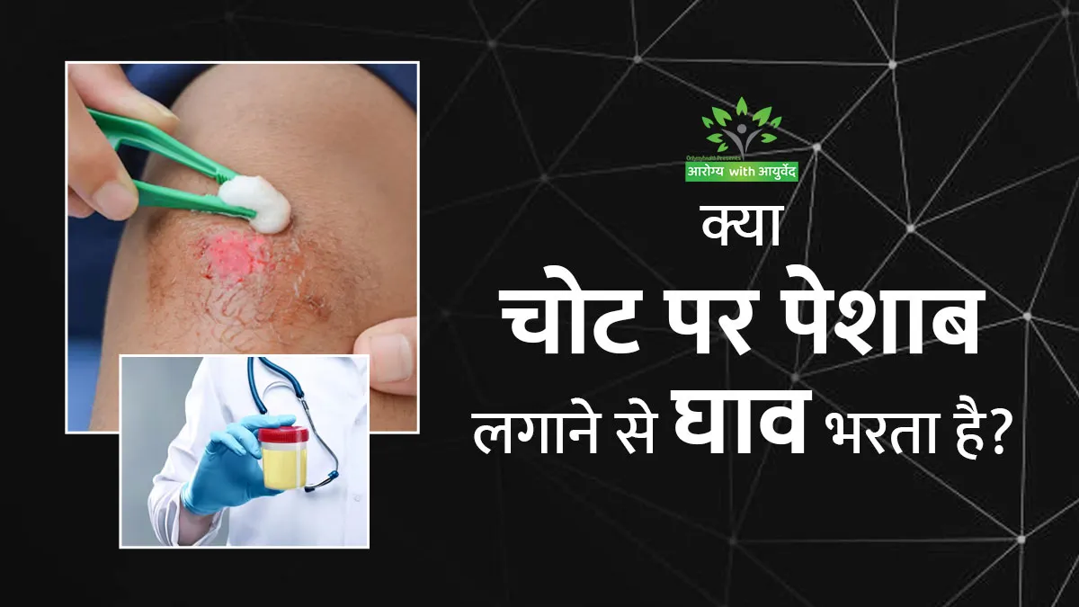 क्या चोट पर पेशाब लगाने से घाव भरता है? जानें डॉक्टर से इसका सच