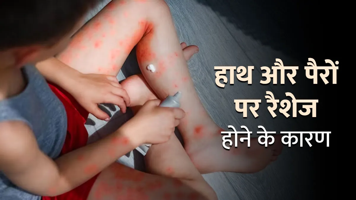 हाथ और पैरों पर रैशेज होने के क्या कारण हैं? डॉक्टर से जानें