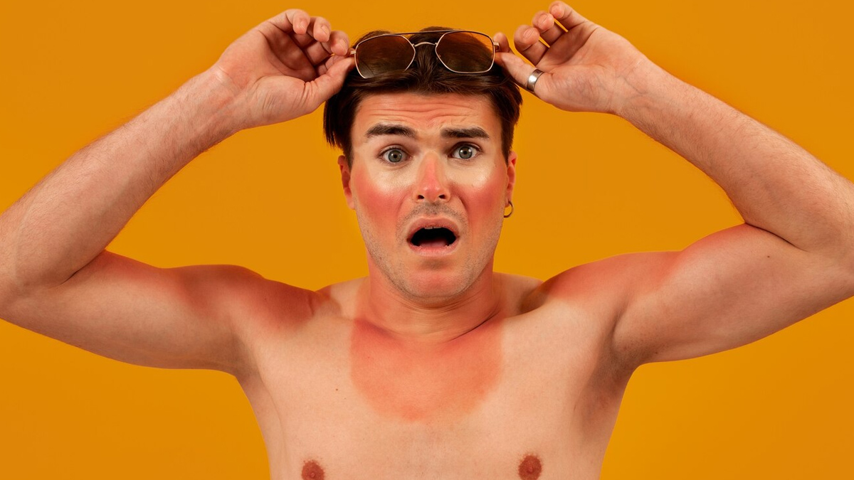 sunburns-inside