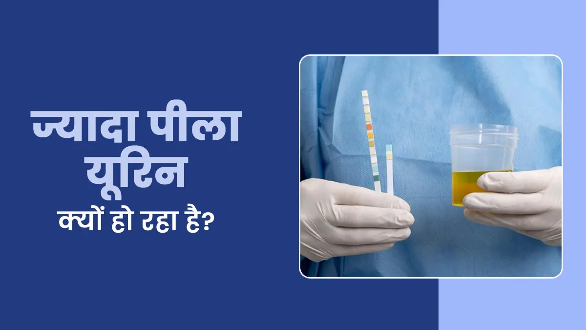 ज्‍यादा पीला या गहरे रंग का यूरिन हो तो रहें सतर्क, ये हो सकते हैं कारण
