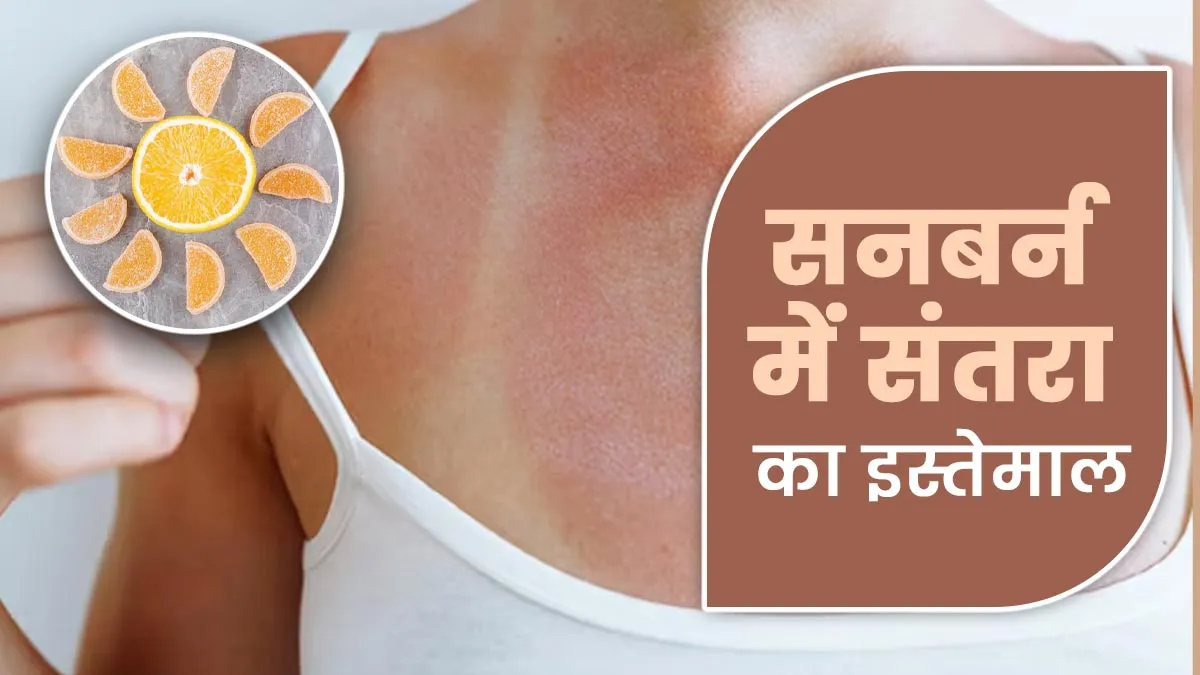 क्या सनबर्न वाली त्वचा पर संतरा लगाना सही है? इस्तेमाल से पहले एक्सपर्ट से जानें