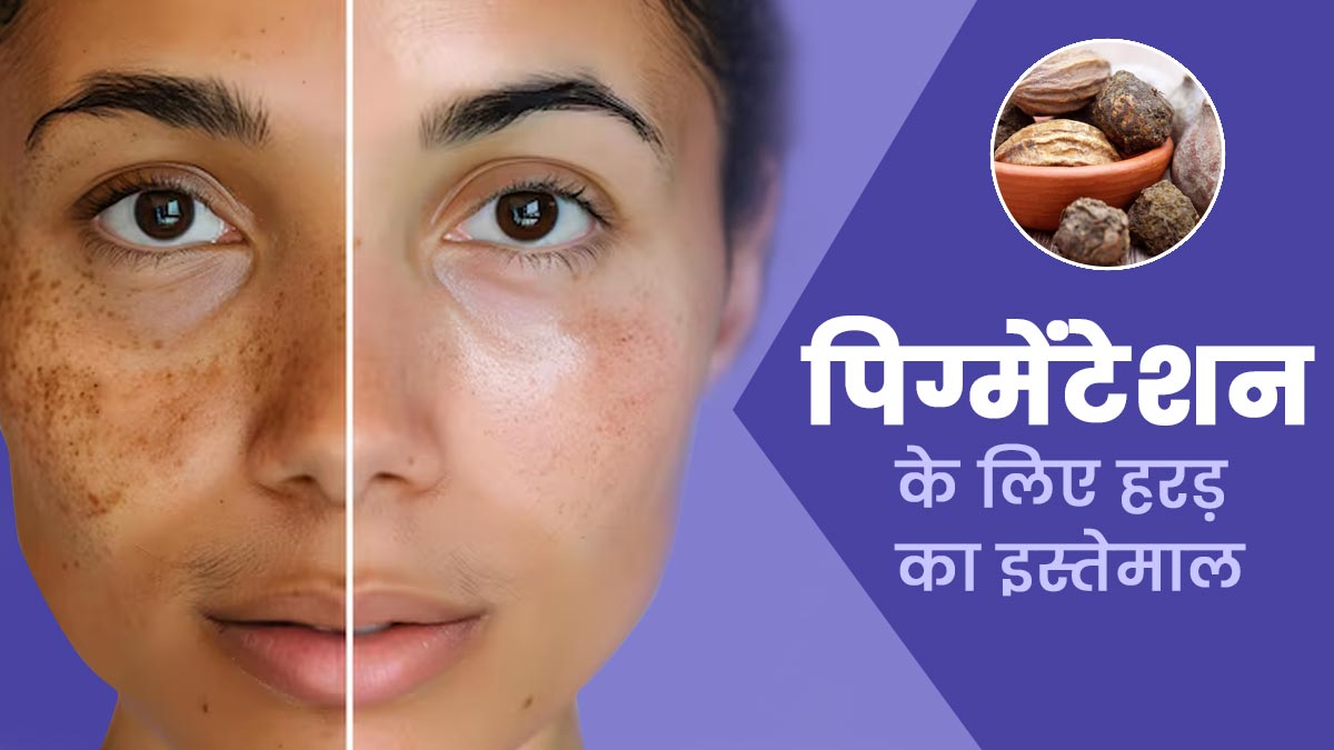 पिग्मेंटेशन के लिए हरड़ का इस्तेमाल कैसे कारगर है? एक्सपर्ट से जानें