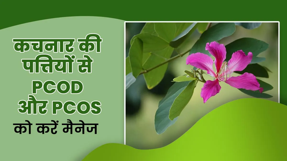 PCOD और PCOS में मददगार हैं कचनार की पत्तियां, जानिए फायदे और इस्तेमाल का तरीका