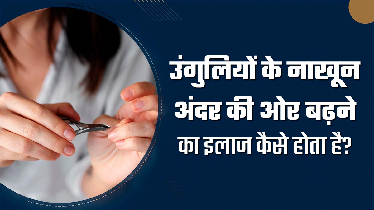 उंगलियों के नाखून अंदर की ओर बढ़ने (Ingrown Fingernail) का इलाज कैसे होता है? डॉक्टर से जानें