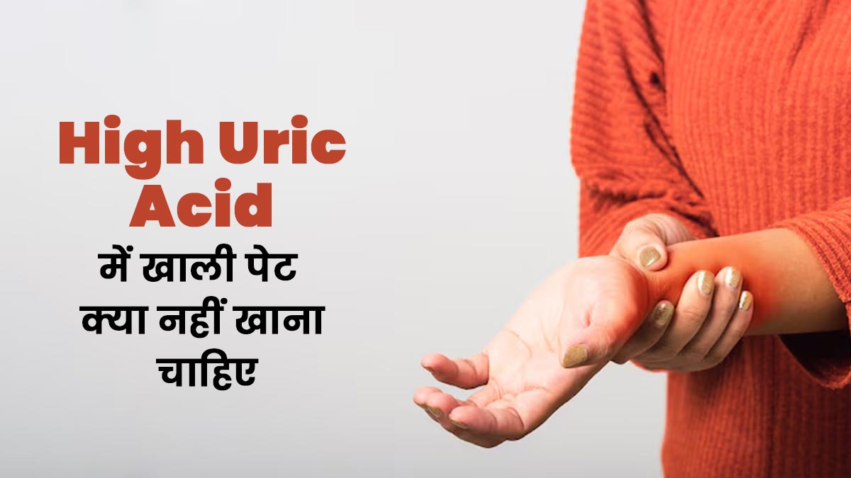 हाई यूरिक एसिड में खाली पेट क्या नहीं खाना चाहिए? बता रहे हैं एक्सपर्ट