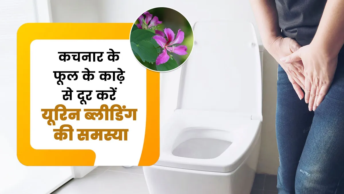 यूरिन ब्लीडिंग और पाइल्स में लाभकारी है कचनार फूल का काढ़ा, जानें सेवन विधि और फायदे