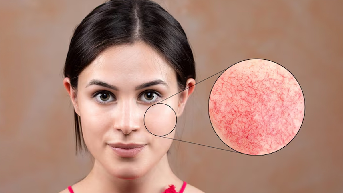 What-Habits-Reduces-Collagen-Production