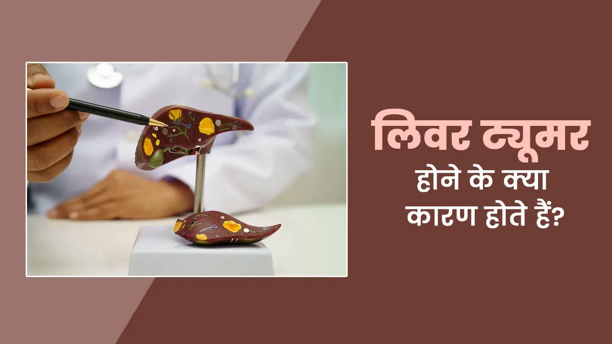 लिवर ट्यूमर होने के क्या कारण होते हैं? डॉक्टर से जानें इसके लक्षण