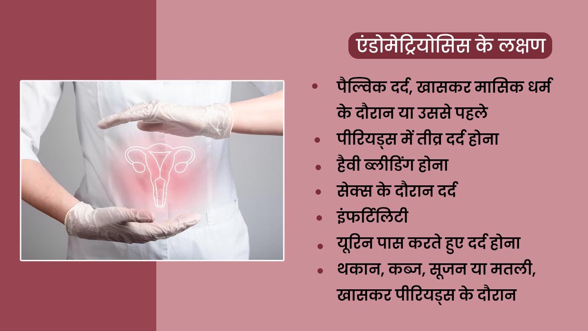 can endometriosis cause back pain 001