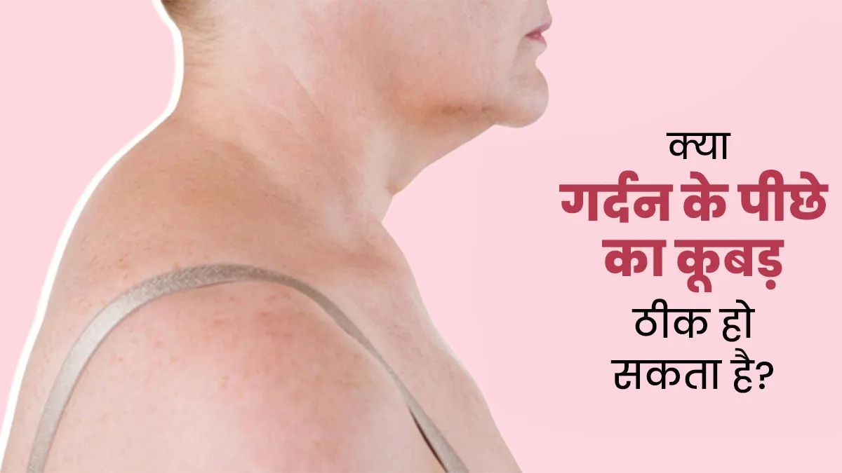 क्या गर्दन के पीछे का कूबड़ ठीक हो सकता है? डॉक्टर से जानें