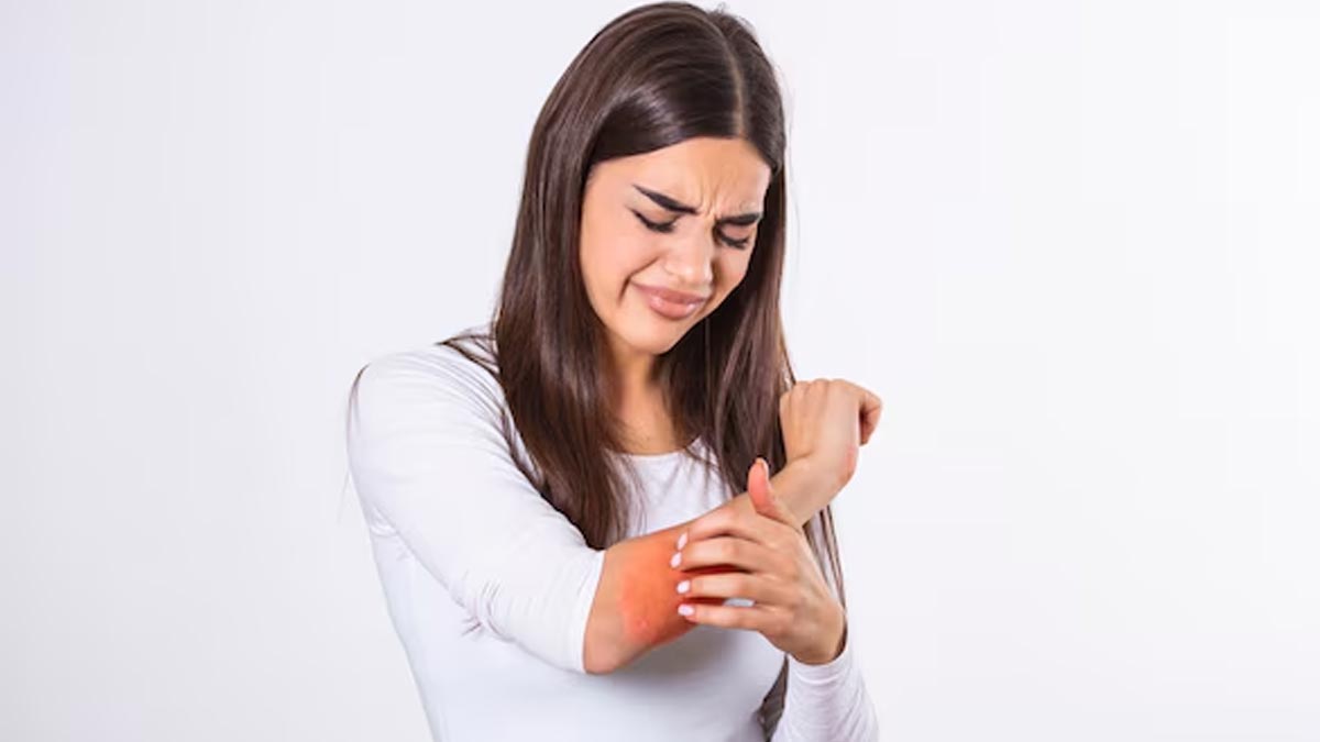 signs of excess collagen 01 (6)