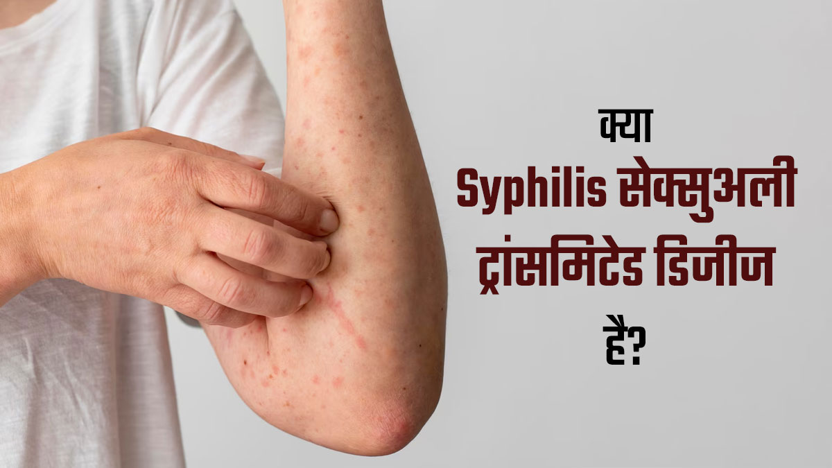 क्या सिफलिस सेक्सुअली ट्रांसमिटेड डिजीज है? समझें डॉक्टर से