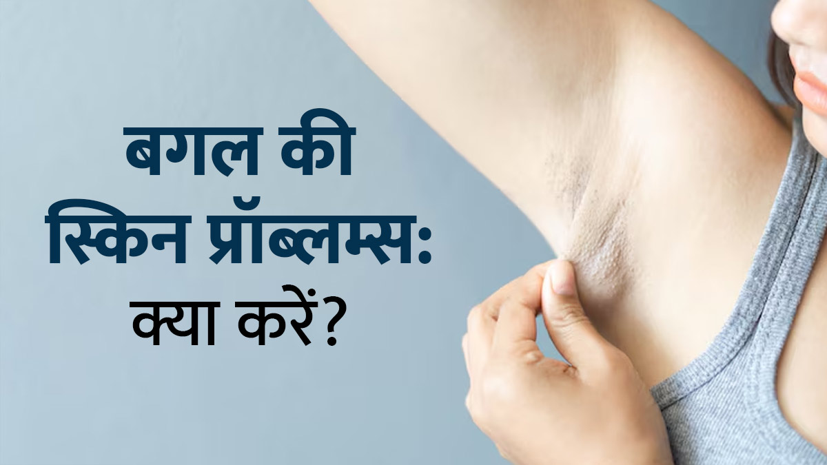 पसीने से बगल में हो रही स्किन प्रॉब्लम्स को दूर करेंगे ये 7 ट‍िप्‍स, खुजली-रैशेज से म‍िलेगी राहत