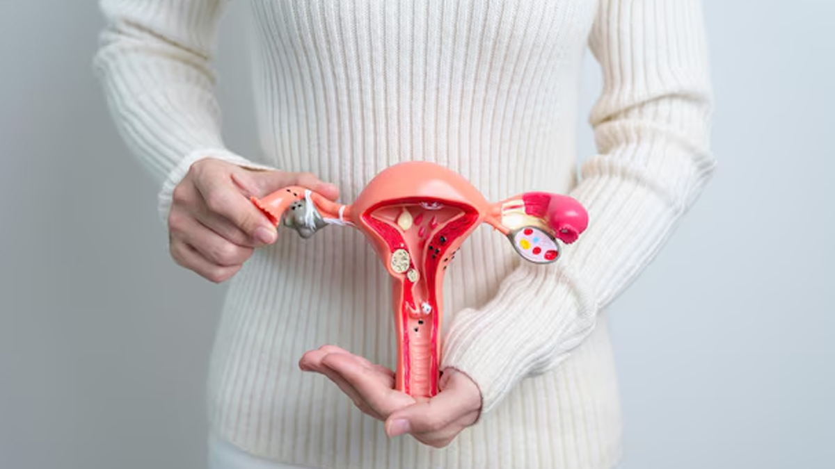 can endometriosis cause weight gain 02