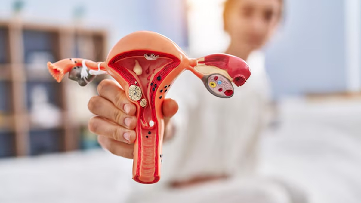 can ovarian cyst cause weight gain